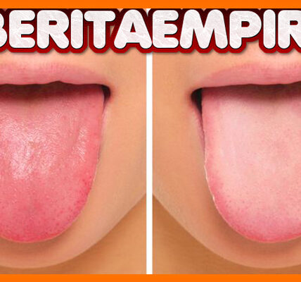 Warna Pada Lidah Bisa Cerminkan Kesehatan Pada Tubuh