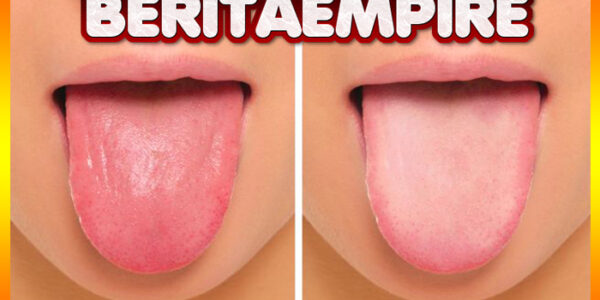 Warna Pada Lidah Bisa Cerminkan Kesehatan Pada Tubuh